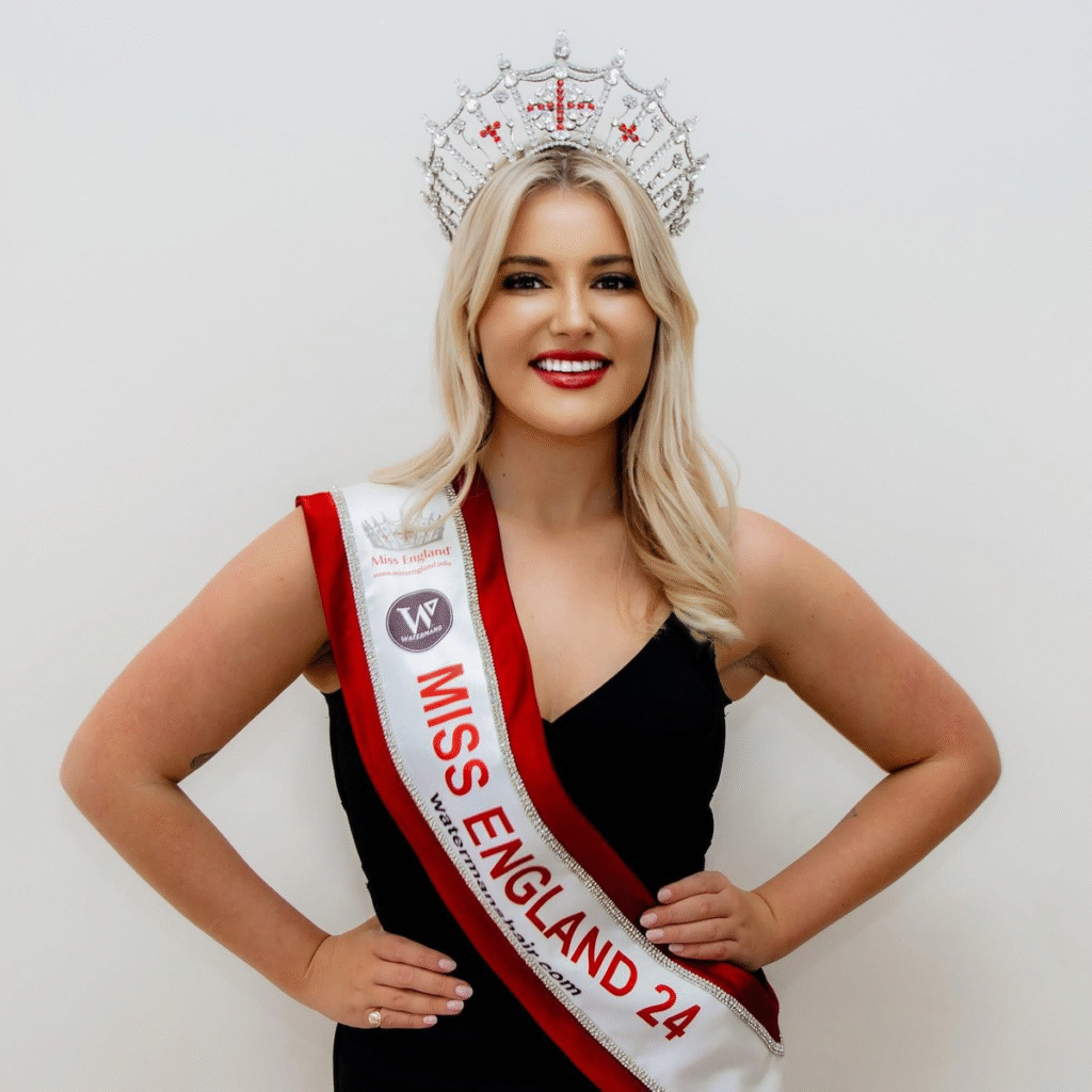 Miss England 2024 Milla Magee Withdraws from Miss World 2025