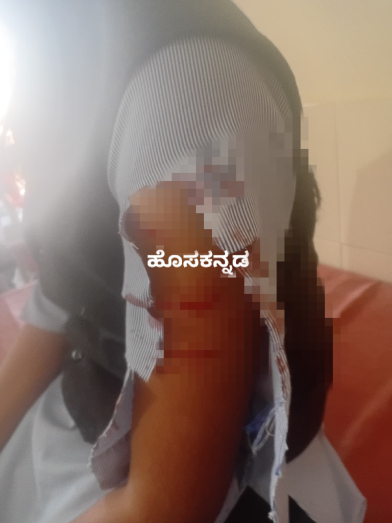 Staged Kidnapping Claim Shocks Dakshina Kannada: Police Uncover Truth Behind Belthangady Student’s Allegation